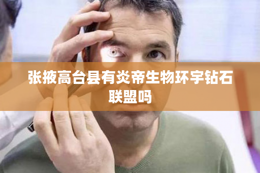 张掖高台县有炎帝生物环宇钻石联盟吗